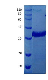 Actin, aortic smooth muscle