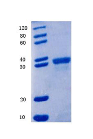 Fibronectin type III domain-containing protein 5