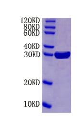 Protein S100-A9