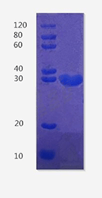 Troponin T, slow skeletal muscle