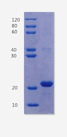 HLA class I histocompatibility antigen, B-27 alpha chain