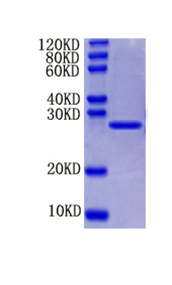 Extracellular matrix protein 1