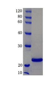 Tyrosine-protein kinase BTK