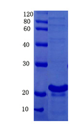 Caspase-8