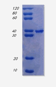 Growth/differentiation factor 15