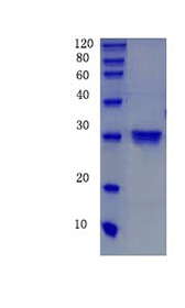 Superoxide dismutase [Mn], mitochondrial