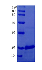 Transmembrane glycoprotein NMB