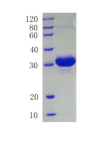 Microtubule-associated proteins 1A/1B light chain 3B