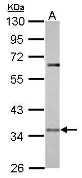 CCR5 Antibody