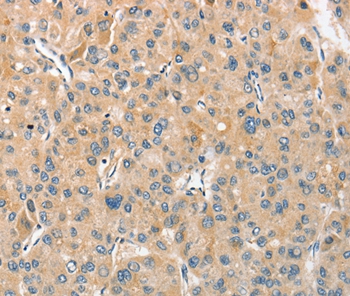 ANGPTL7 Antibody