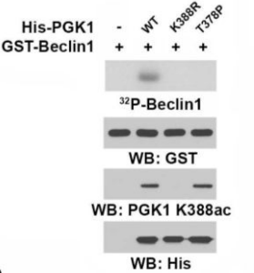 PGK1 (Acetyl-Lys388)  Antibody