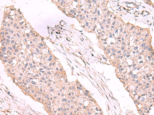 ESM1 Antibody