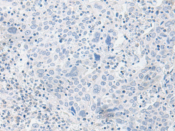 EIF2S3 Antibody