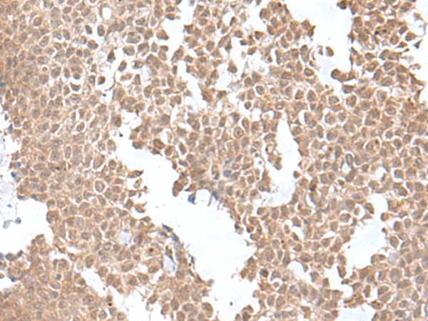 SNRNP25 Antibody