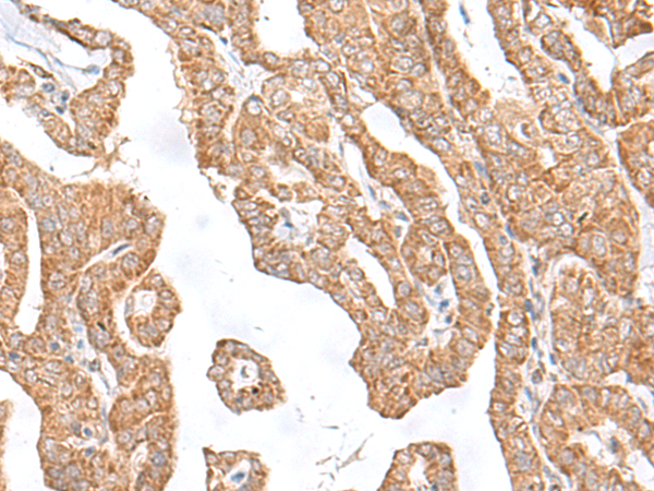 C8orf44 Antibody