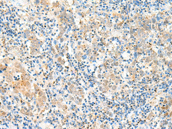 LPXN Antibody