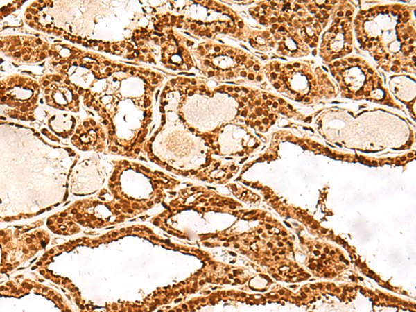 ADRM1 Antibody