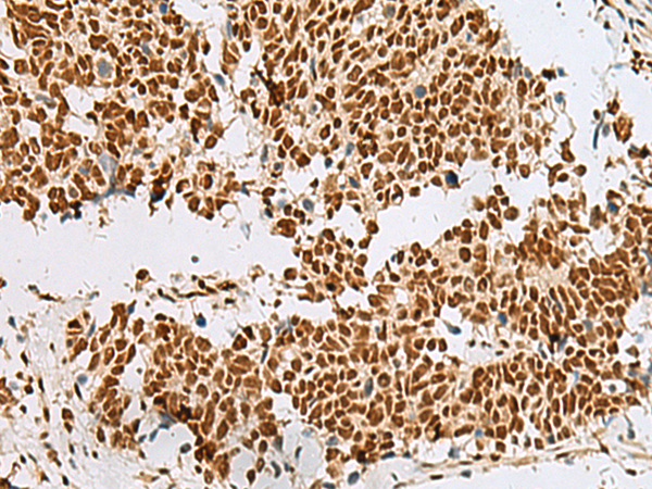 RBM12 Antibody