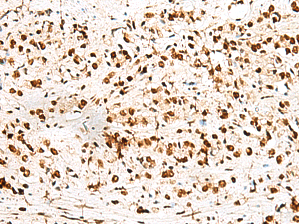 RBM12 Antibody