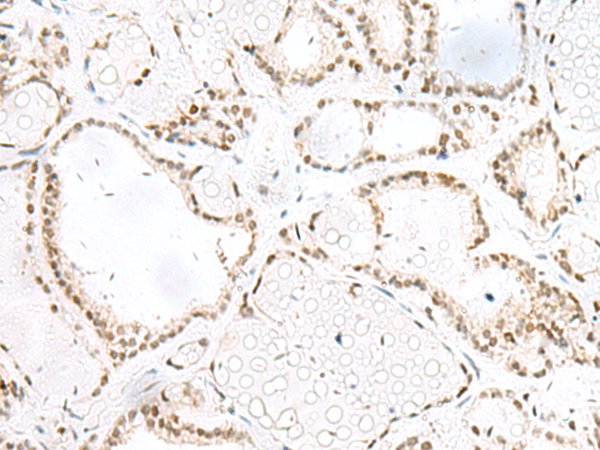 GTF2A2 Antibody