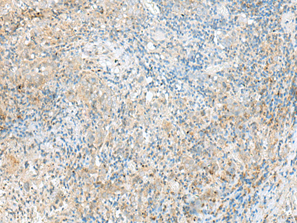 RPP14 Antibody