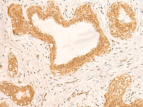 ZNF580 Antibody