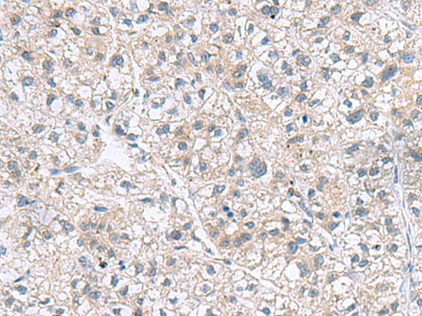 GEMIN7 Antibody