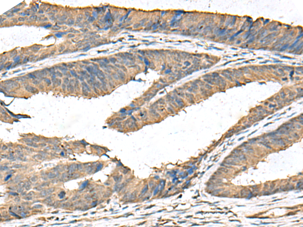 FAM19A4 Antibody