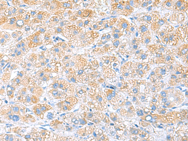 RPS16 Antibody