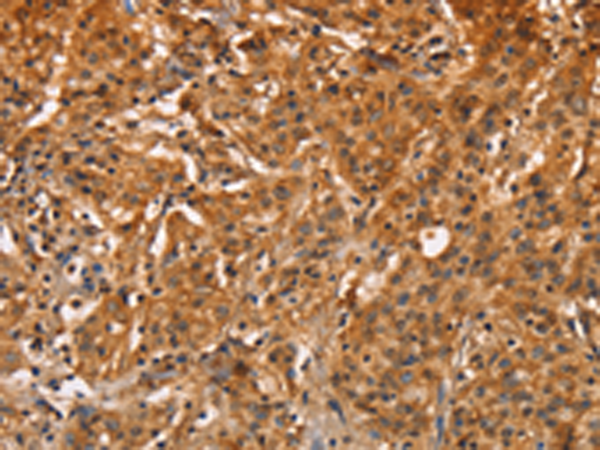 ZFP64 Antibody