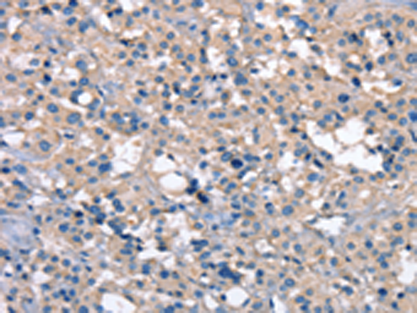 ZFYVE16 Antibody