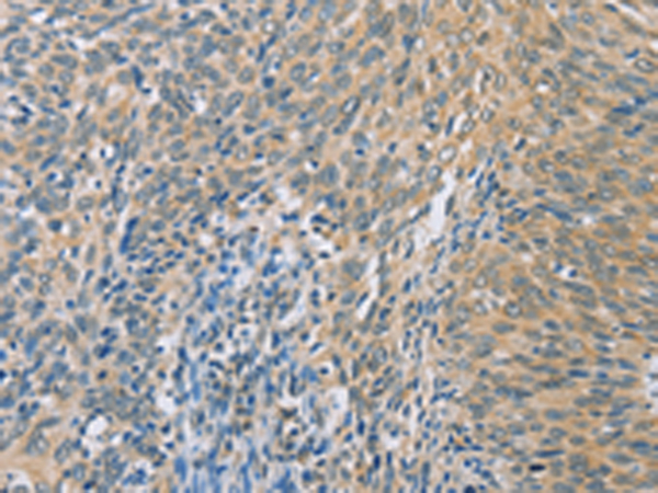 ZHX3 Antibody