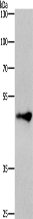 ZIC3 Antibody