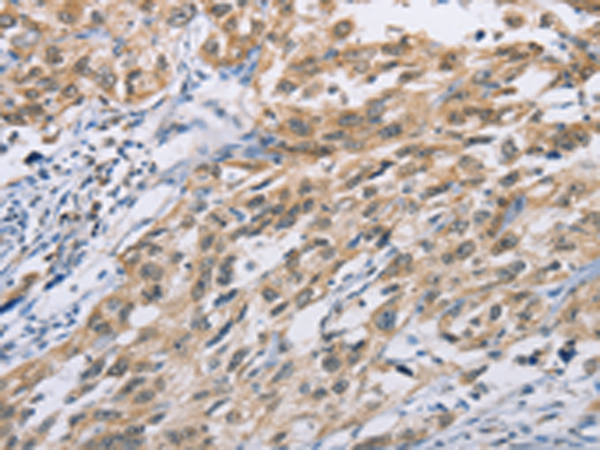 ZIC5 Antibody