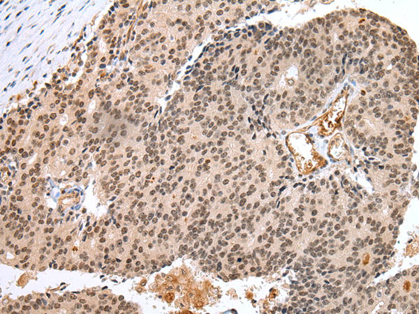 FOXP1  Antibody