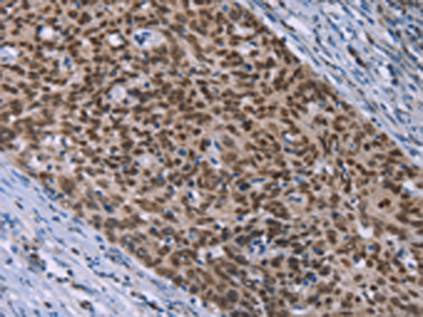 HMGA1  Antibody