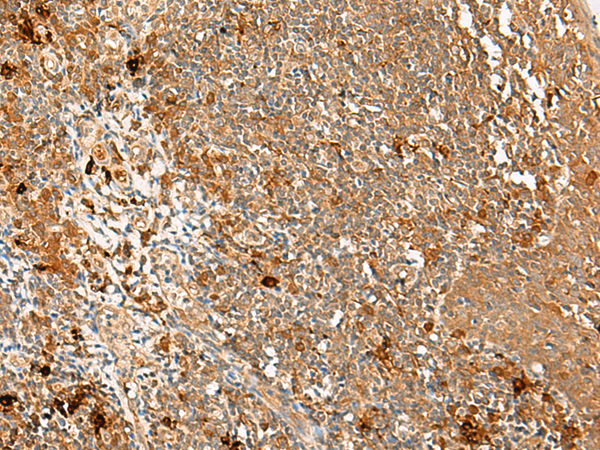 METTL17 Antibody