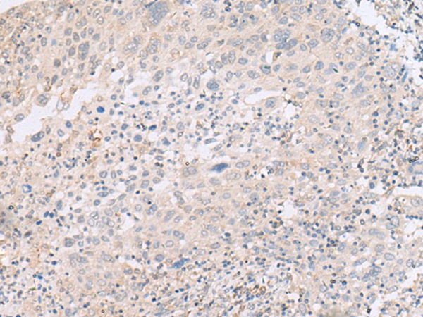 ABHD17B Antibody