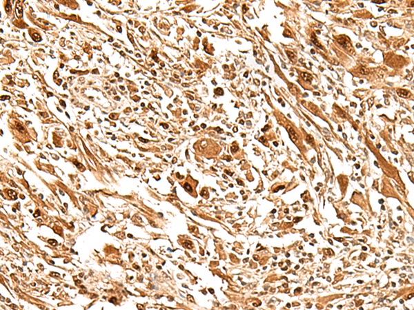 FIZ1 Antibody