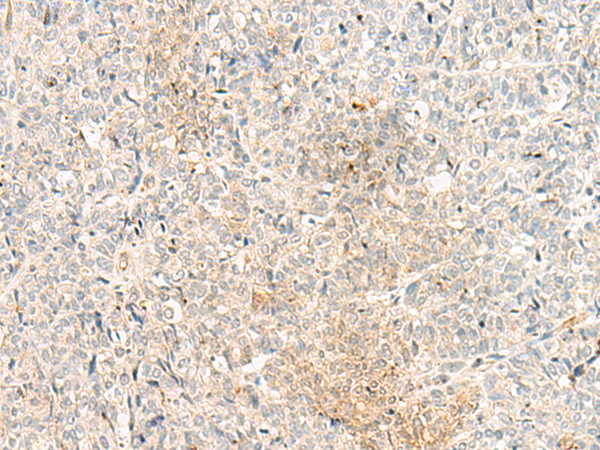 ADGRG6 Antibody