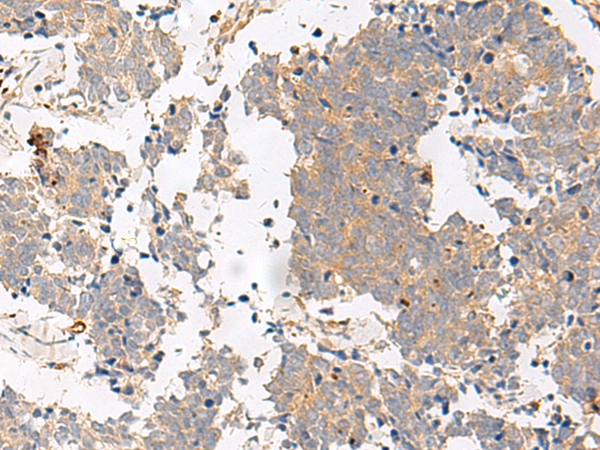 GPR153 Antibody