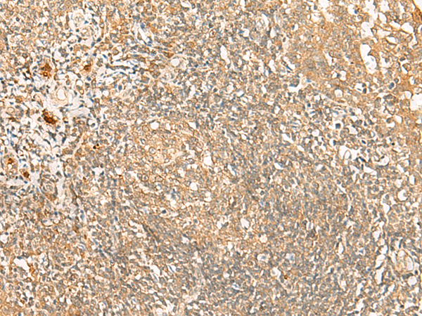 PROKR1 Antibody