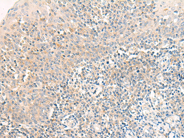 RAPGEF1 Antibody