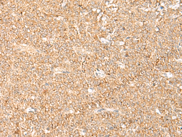 LGALSL Antibody