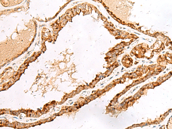 LGALSL Antibody