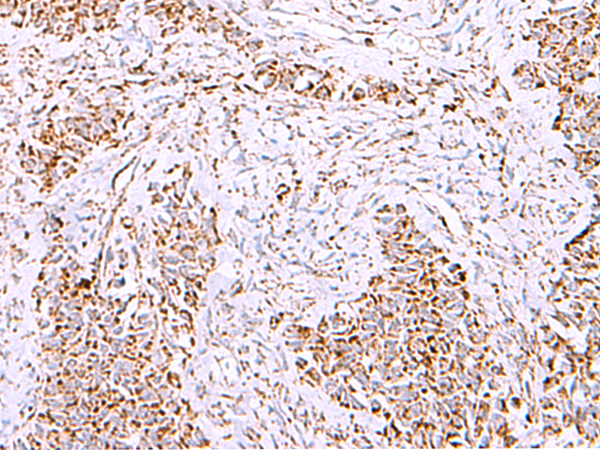 HSF2BP Antibody