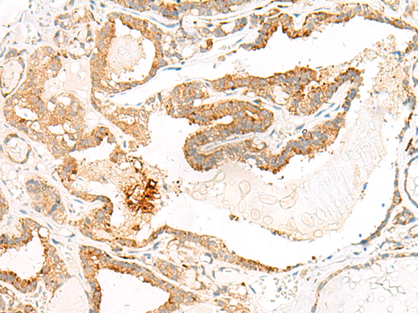 HEBP1 Antibody