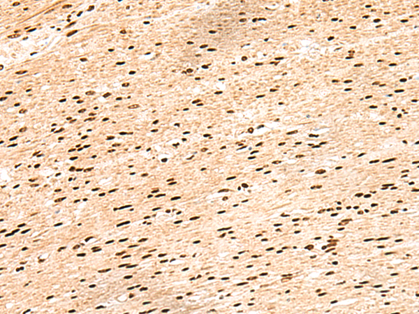 HIST1H1D Antibody