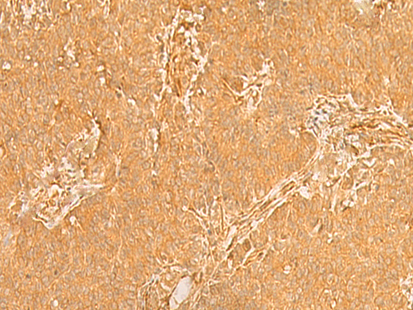 KRT76 Antibody