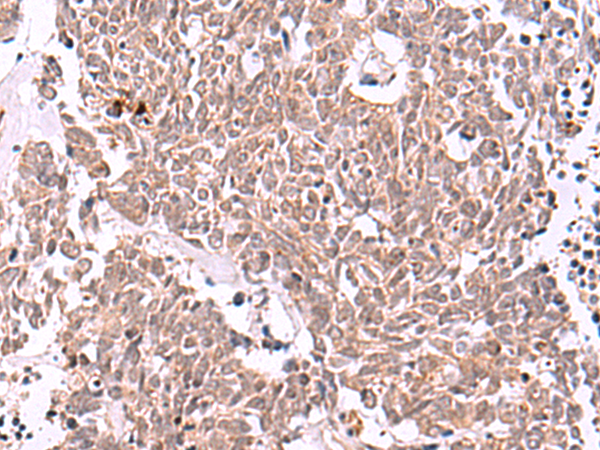 IRX4 Antibody